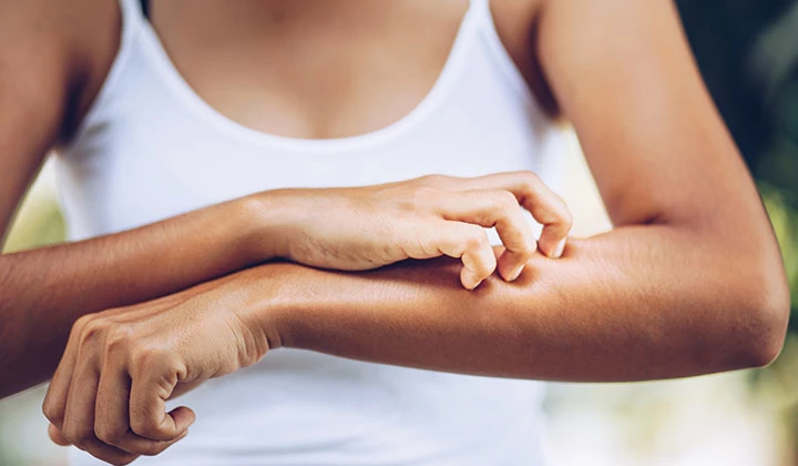 Frau kratzt sich wegen Juckreiz Frau kratzt sich wegen Juckreiz