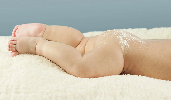 Gepflegter Baby Po Windeldermatitis & Ernährung bedingen einander