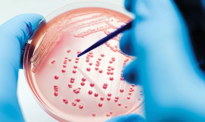 Laborprobe  Hautpilz lässt sich durch einen Arzt feststellen