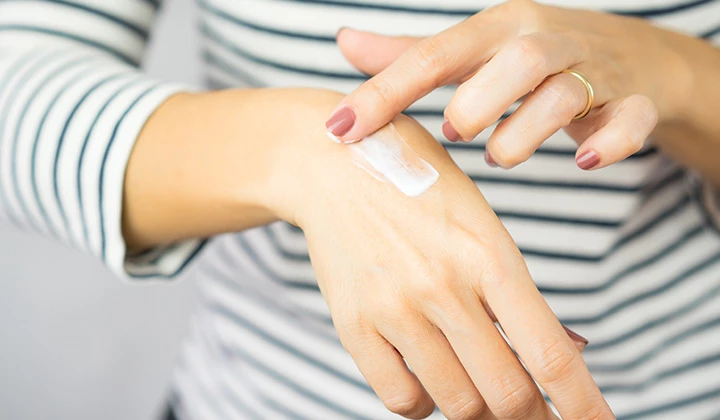 Frau trägt Salbe auf Spezielle Salben helfen bei Dermatitis