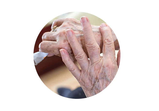 Patient cremt Hände ein  Wundsalbe bei Dekubitus