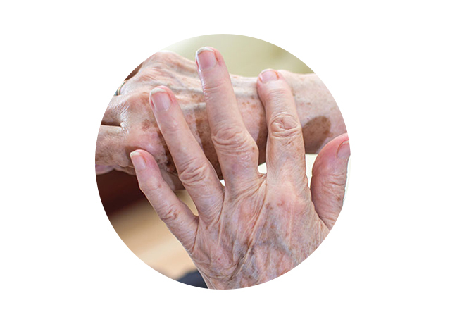 Hautpflege zur Wundpflege für Pflegebedürftige