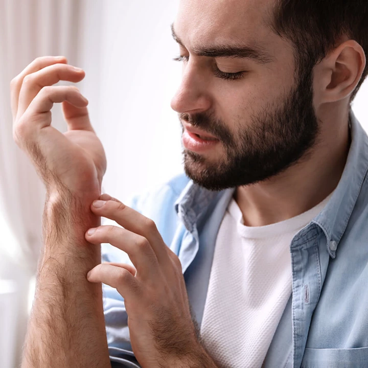 Mann kratzt Handgelenk Mann kratzt sich wegen Juckreiz